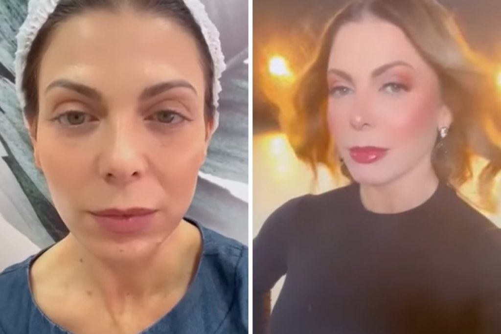 Sheila Mello antes e depois