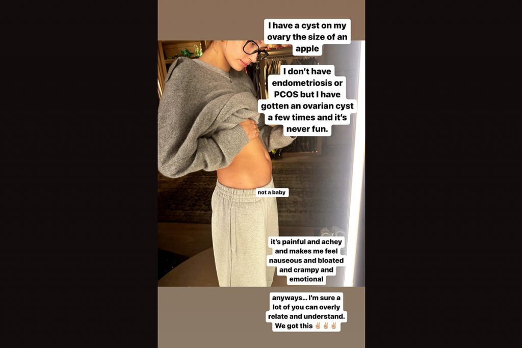 Haily Bieber mostra barriga inchada e explica o motivo