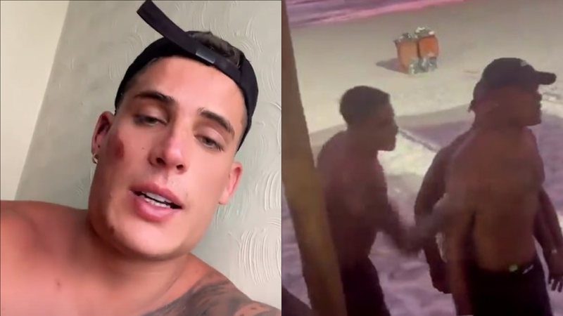 Apanhou! Tiago Ramos surge com rosto machucado após brigar com homem na praia: “Provocou”; veja vídeo