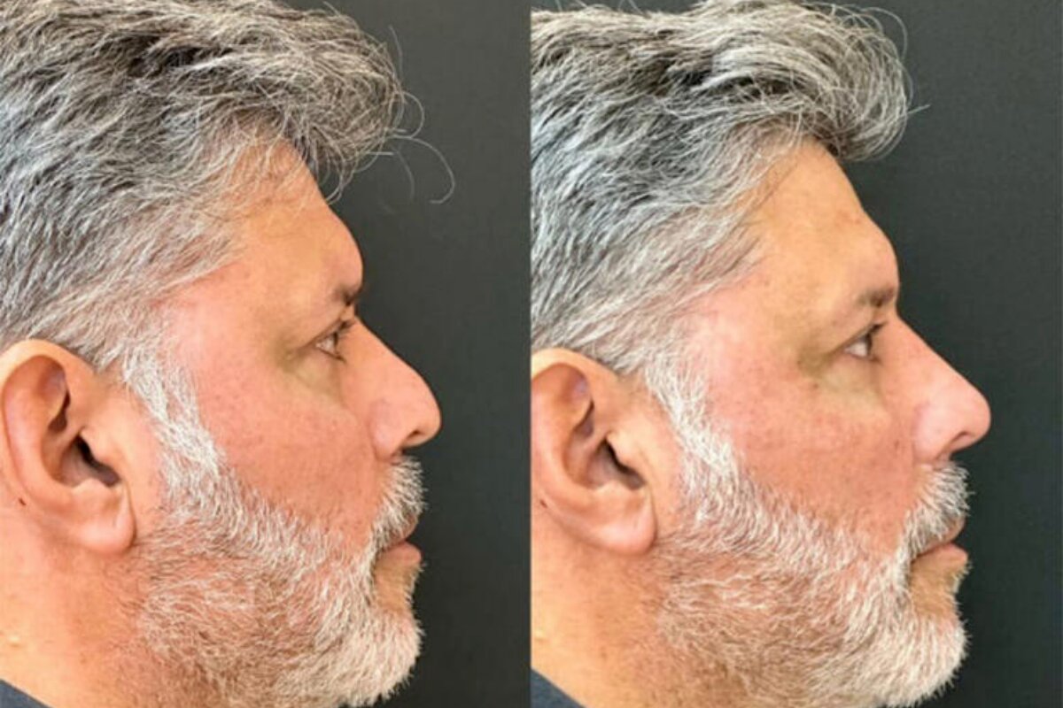 Alexandre Frota de perfil