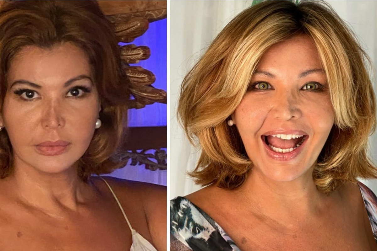 Antes e depois Roberta Close