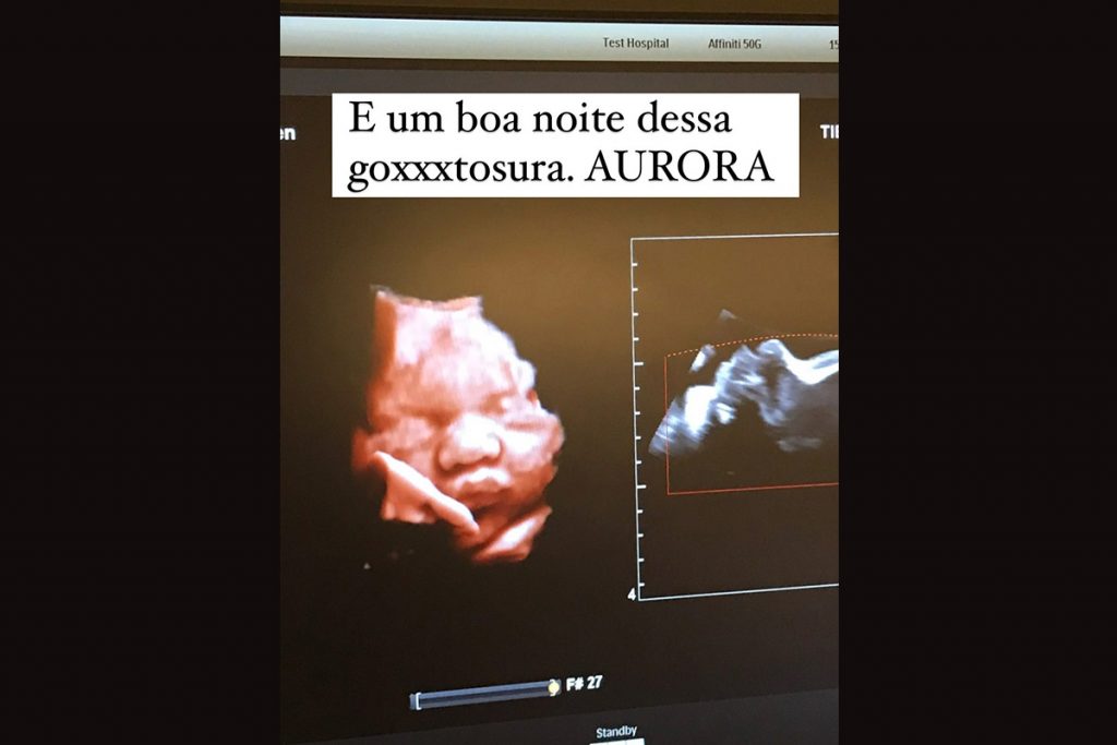 ultrassom-aurora-1024x683-1 Cintia Dicker mostra ultrassom da filha Aurora