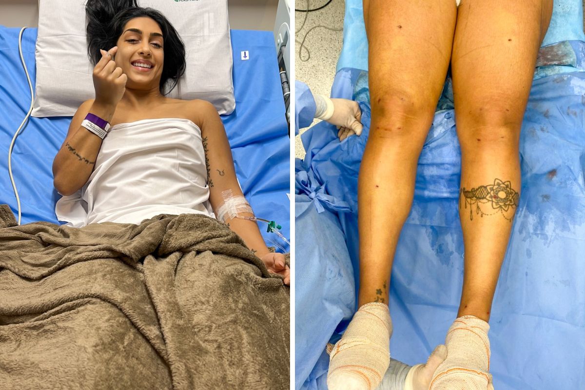 Ex-BBB Amanda Djehdian exibe bumbum e mostra como tratamento tem melhorado  lipedema