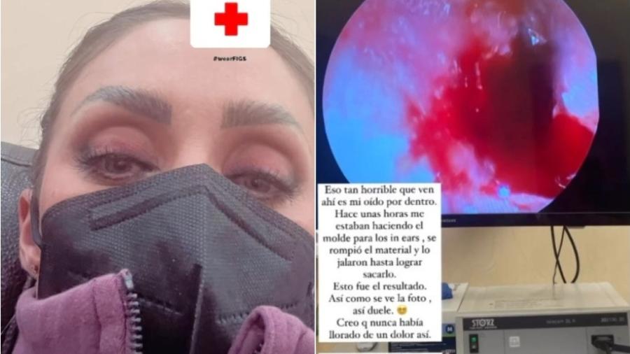 Anahí tem tímpano perfurado: “Estou em choque”