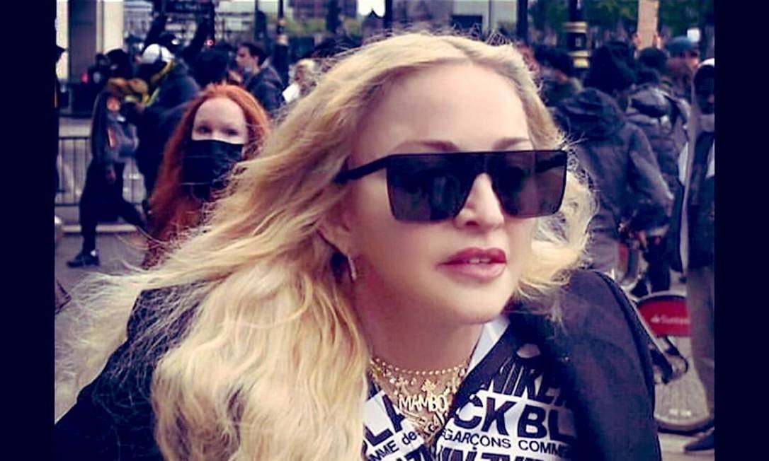 Madonna é internada em UTI após contrair infecção bacteriana