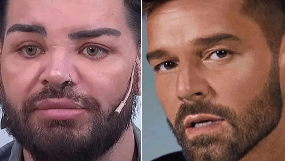 Ator faz 30 cirurgias plásticas para se parecer com Ricky Martin