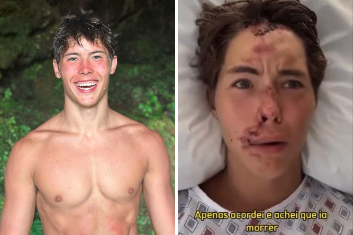 caleb coffee após cair em lava