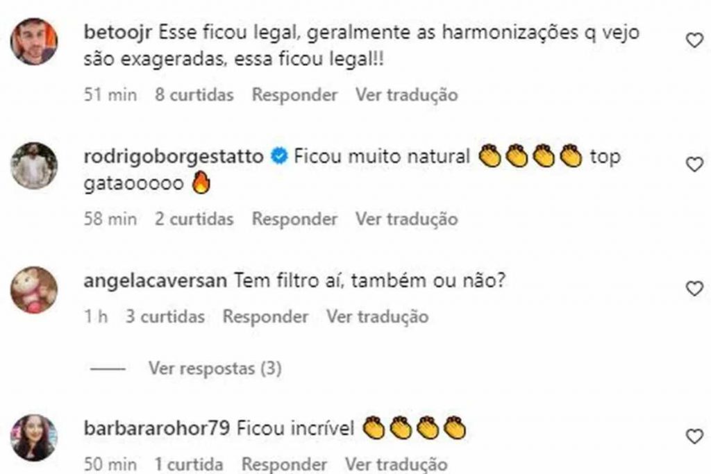 Elogios harmonização Rafael Ilha