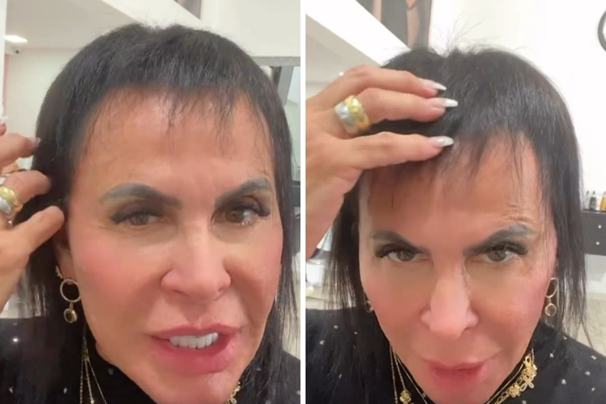 Gretchen mostra o crescimento do cabelo, em meio a tratamento contra alopecia