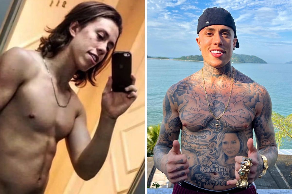 MC Daniel antes e depois de procedimentos estéticos