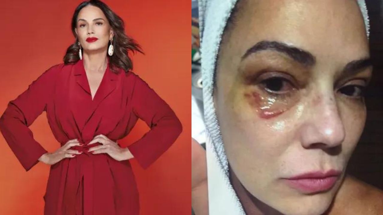 Luíza Brunet pede indenização milionária por agressão de ex-marido Lorena Bueri