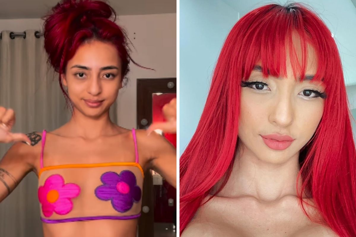 Ruivinha de Marte com antes e depois das próteses de silicone