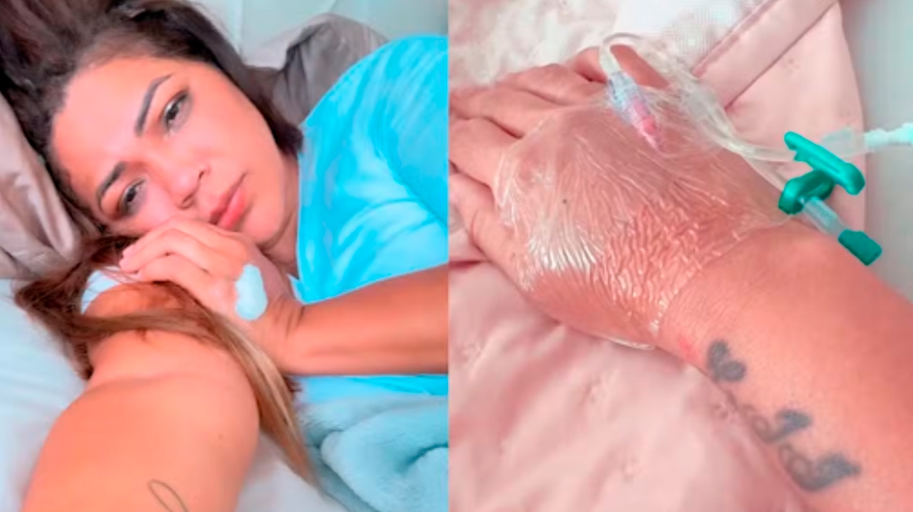 Colite intestinal: mãe de Lexa se recupera de diagnóstico da doença Lorena Bueri