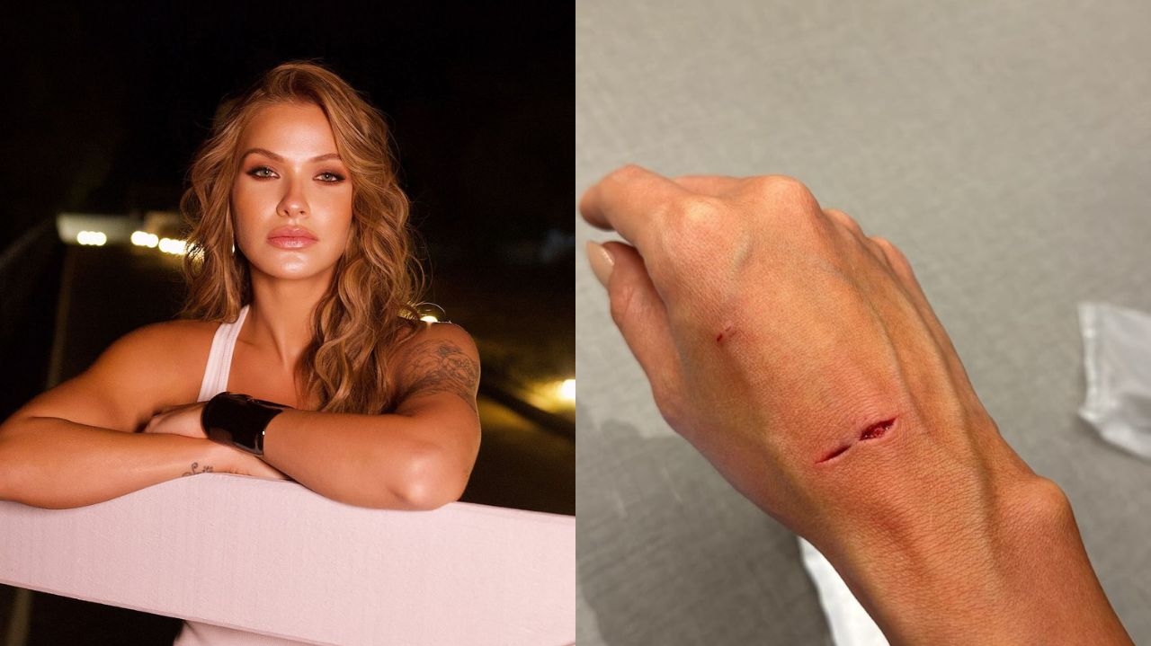 Andressa Suita relata acidente com box de banheiro e faz alerta Lorena Bueri