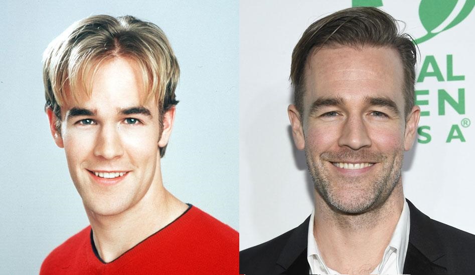 Astro de ‘Dawson’s Creek’ revela diagnóstico de câncer colorretal
