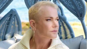 Xuxa Meneghel passa por cirurgia no joelho