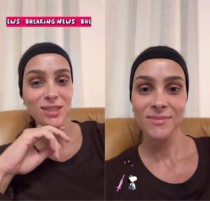 Letícia Cazarré revela procedimento estético no rosto: – O pós-operatório é meio chatinho