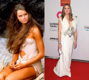 Para sempre um clássico! Veja o antes e o depois do elenco de A Lagoa Azul