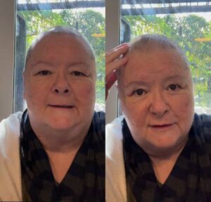 De cabelo raspado, atriz de Babe: Um Porquinho Atrapalhado anuncia que está com câncer raro
