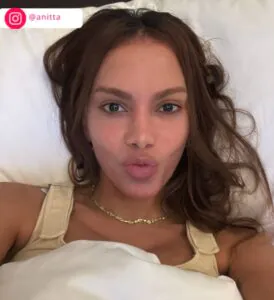 Novo face card! Confira todas as mudanças físicas feitas por Anitta