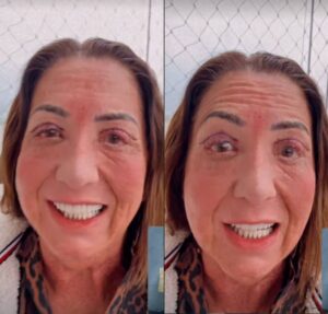 Mãe de Virginia Fonseca faz procedimento estético no olho e mostra resultado: – Eram muito fechados