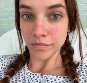 Barbara Palvin revela luta contra endometriose e desabafa sobre cirurgia: Agora sei a diferença