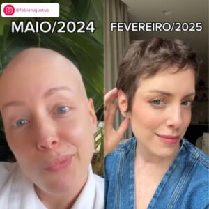 Veja as vezes que Fabiana Justus falou sobre o crescimento do cabelo durante tratamento contra o câncer