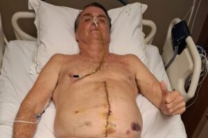 Bolsonaro deixa a prisão domiciliar para ir ao hospital. Saiba tudo!