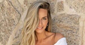 Assustada! Mariana Weickert emociona ao revelar câncer de pele: ‘Nunca passou pela cabeça’