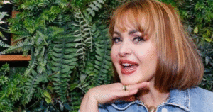 Gaby Spanic passa por harmonização facial; veja o antes e depois