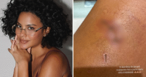 Bella Campos revela qual foi maior dificuldade que enfrentou ao gravar uma novela: ‘Mordida de jacaré’