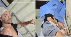 Kayky Brito sofre acidente de bicicleta e leva pontos na cabeça após cair em buraco: ‘Fiquei mais remendado’