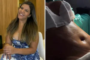 Mani Reggo mostra o corpo após cirurgia estética e impressiona