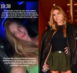 Virginia Fonseca celebra resultado de procedimento no rosto: Amando sair sem make