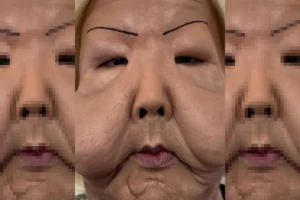 Juju do Pix reaparece e mostra evolução após cirurgia delicada no rosto; veja como ela está