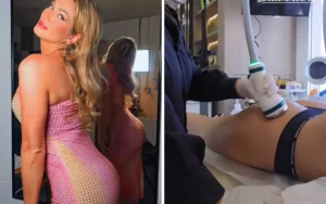 Lívia Andrade faz procedimento para ficar com bumbum matador