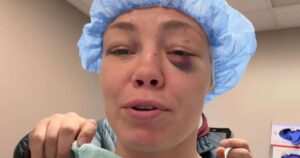 Culpa de brasileira? Ex-campeã do UFC passa por cirurgia e revela restrição após luta