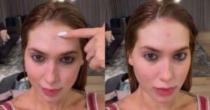 Virginia expõe marcas causadas por fantasia após ensaio da Grande Rio