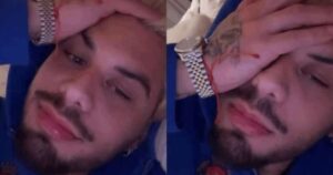 GRAVE? Zé Felipe sofre acidente, fica ferido e vai às pressas para o hospital