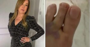 Grave? Zilu revela estado de saúde após acidente doméstico