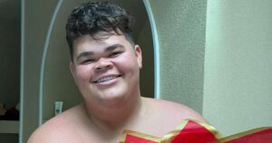 Gordão da XJ passará por cirurgia após perder 130 kg: ‘Estou com medo’