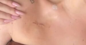 Neta de Carlos Alberto de Nóbrega mostra cicatriz após passar por cirurgia de câncer de mama