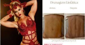 Virginia impressiona com antes e depois após drenagem linfática; conheça os benefícios