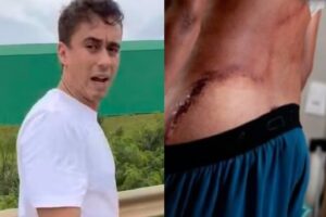 Adolescente atingido por raio em ato de Nikolas Ferreira recebe alta