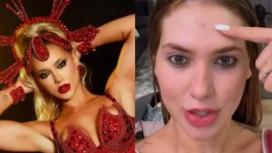 Virginia se machuca após ensaio de rua com a Grande Rio: ‘Doendo’