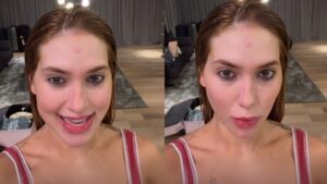 Virginia Fonseca exibe antes e depois de procedimento na barriga; compare