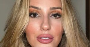 Amanda Meirelles choca ao exibir antes e depois do processo de emagrecimento