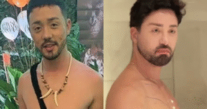 Rico Melquiades faz 15 cirurgias plásticas e diz que não vai parar