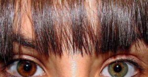 Heterocromia: famosos que têm um olho de cada cor