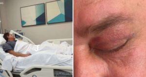 Leonardo mostra resultado de cirurgia plástica nos olhos: ‘Rejuvenesceu 10 anos’